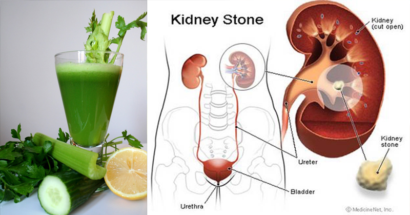 5 Things to Avoid for a Healthy Kidney and A Juice Recipe to Repair It