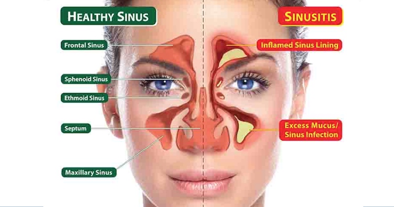 why-mucus-is-good-for-you