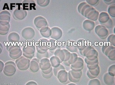 life blood cell analysis after