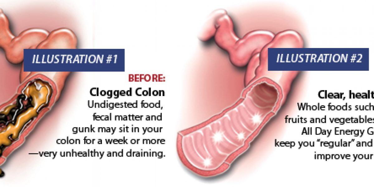 Symptoms, Causes And Cure For Chronic Bad Breath (Detox Recipe Included)