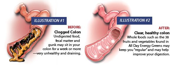 colon cleanse