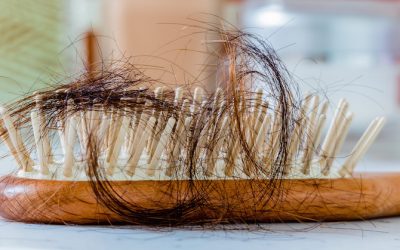 Excessive Hair Loss May Reflect A Poor Immune System