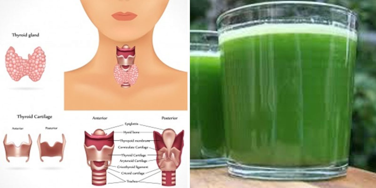 How To Spot The Symptoms Of Hyperthyroidism And The Best Green Juice To Prevent It (Recipe Included)