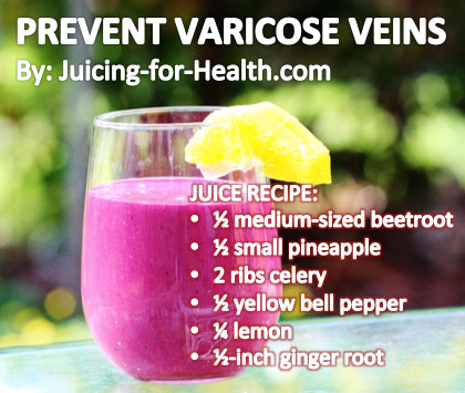 juice-varicose-veins-new
