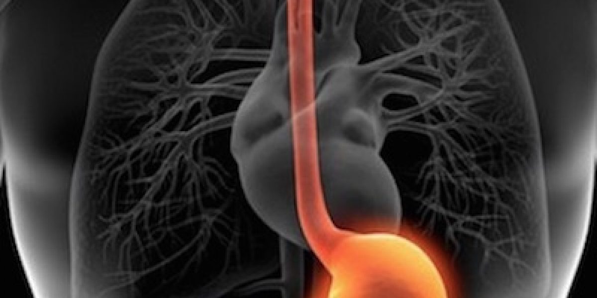 Serious Medical Mistake About Acid Reflux And Stomach Acid That Affects Millions Of People