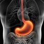 Serious Medical Mistake About Acid Reflux And Stomach Acid That Affects Millions Of People