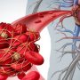 9 Safe, Natural Blood Thinners To Reduce Blood Clots (Thrombosis) And Risk of Stroke