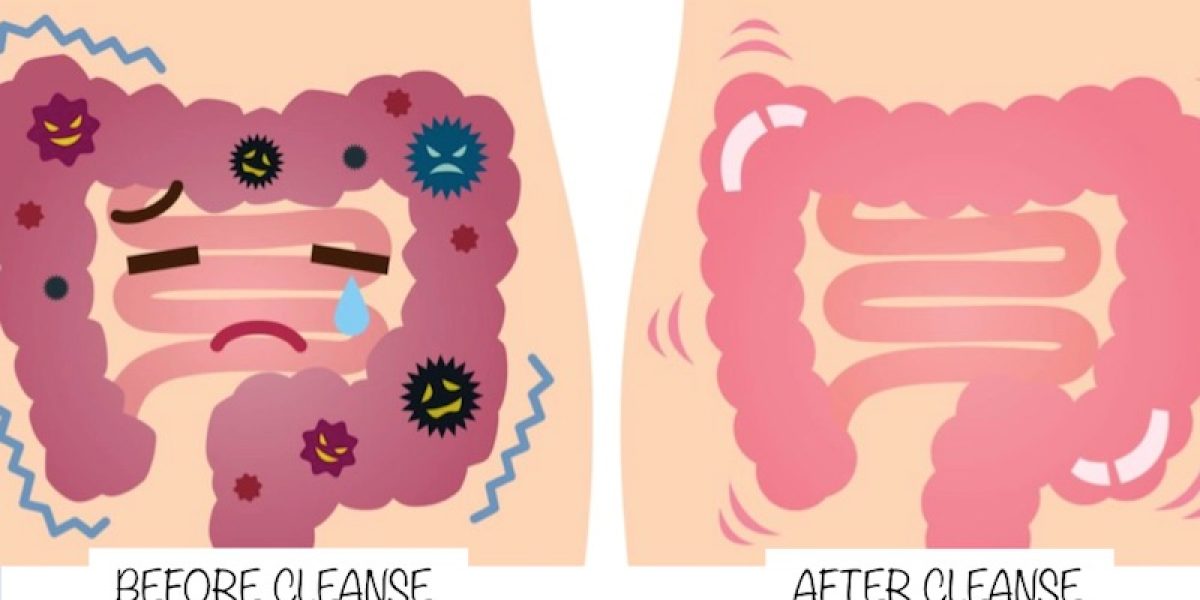 Gastrointestinal Cleanse: A Complete Guide To Flush Out Pounds Of Old Fecal Encrustrations