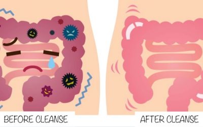 Gastrointestinal Cleanse: A Complete Guide To Flush Out Pounds Of Old Fecal Encrustrations