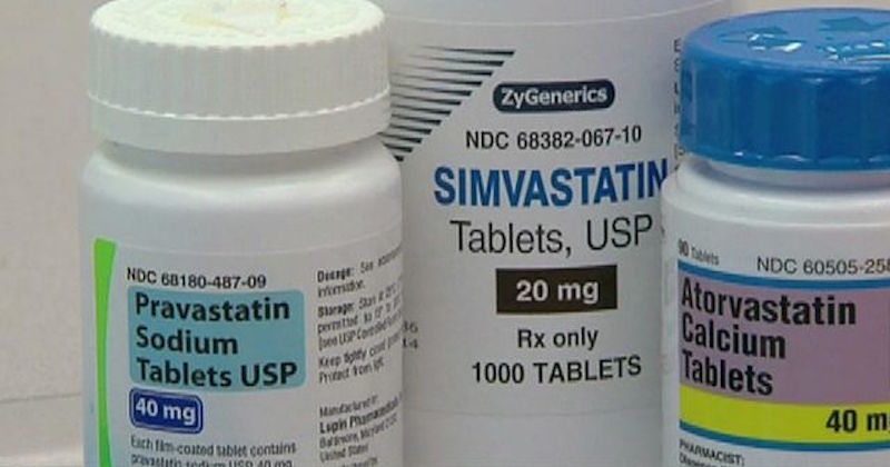 cholesterol and statin