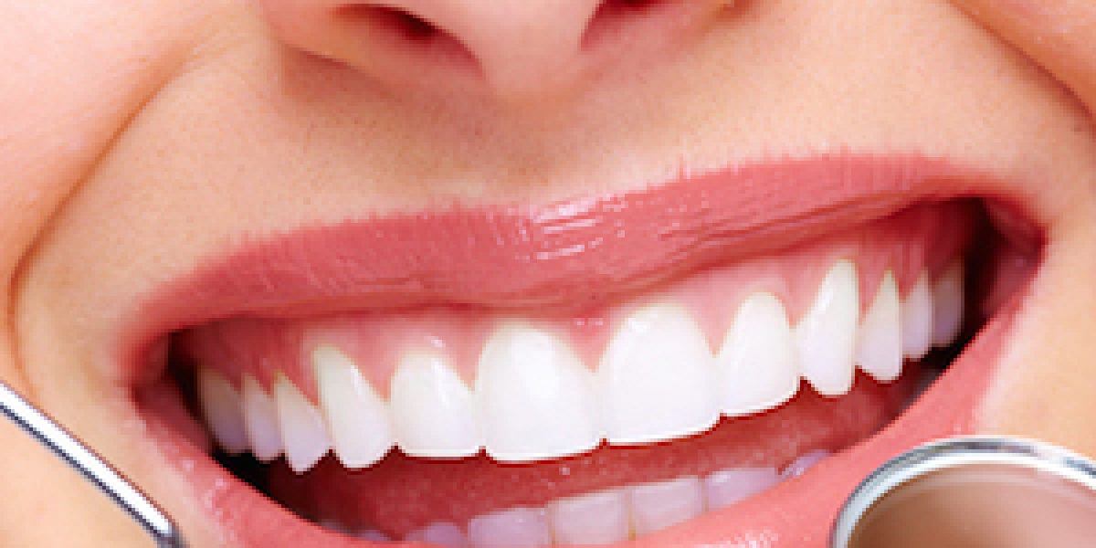 Easily Remove Tartar Buildup On Your Teeth Without Going To The Dentist