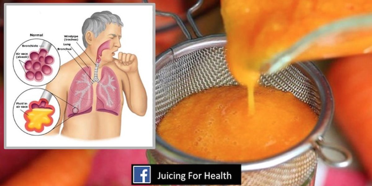 2-Ingredient Homemade Syrup To Stop Cough And Phlegm