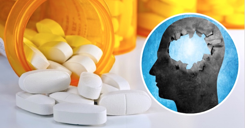 Prescription drugs can cause memory loss and brain issues