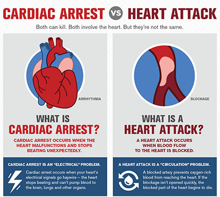 What Happens During A Heart Attack - Why You Need To Know This