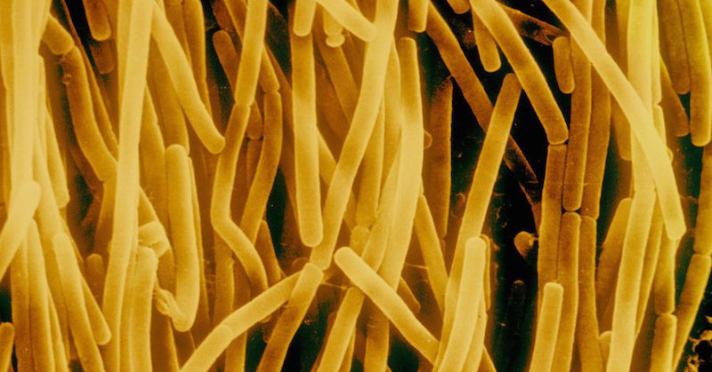 These stomach bacteria cause weight gain.