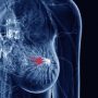The Common Mineral Deficiency That Increases Risk Of Breast Cancer