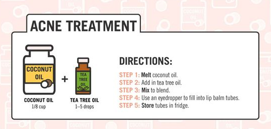 coconut oil acne treatment