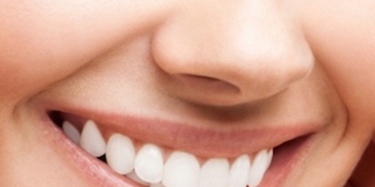 5 Natural Ways To Whiten Your Teeth And Reverse Gum Disease