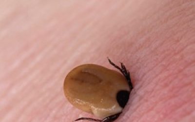 What Is Lyme Disease, How You Can Protect Yourself And Prevent An Infection