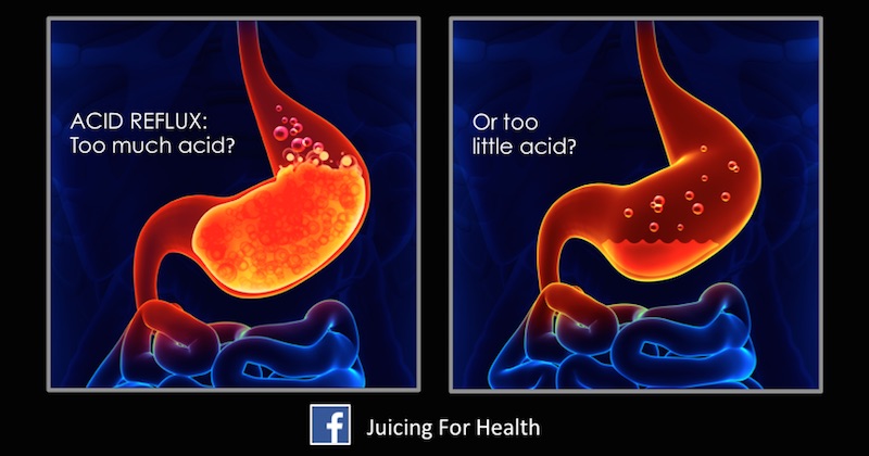 acid reflux test low high stomach acid