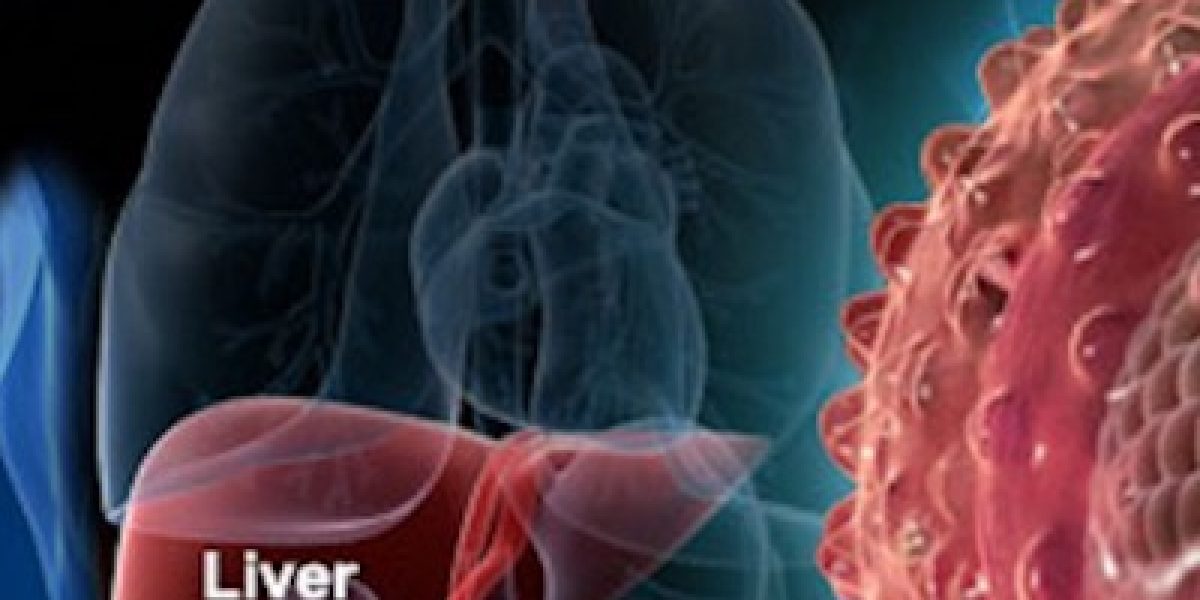 Chronic Liver Disease Symptoms And What You Can Do To Naturally Reverse It