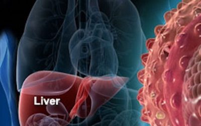 Chronic Liver Disease Symptoms And What You Can Do To Naturally Reverse It