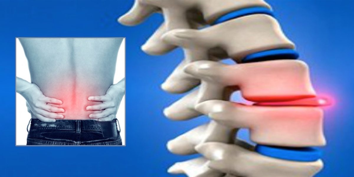 5 Early Warning Signs That You May Have A Slipped Disc And Stretches That Help