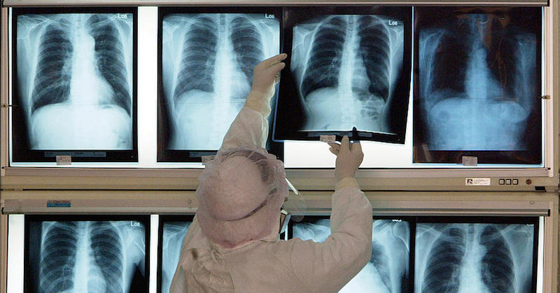 x-ray radiation