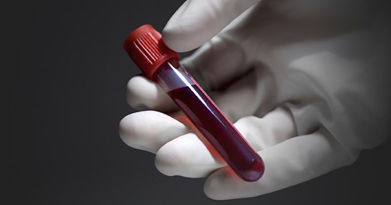 What Your Blood Type Can Tell You Concerning Your Health Risks
