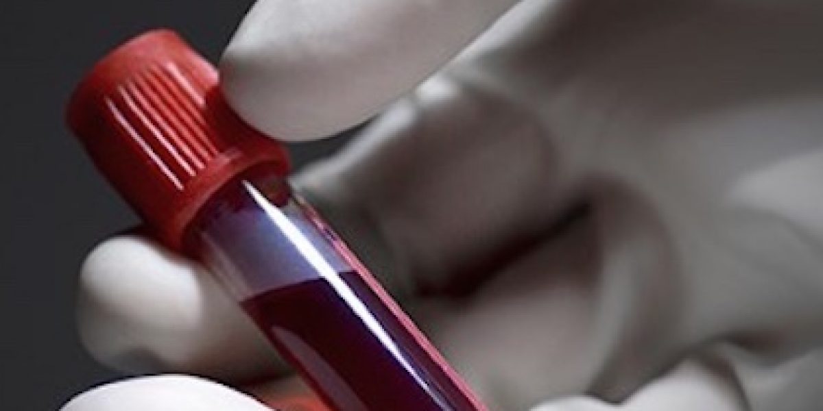 What Your Blood Type Can Tell You Concerning Your Health Risks