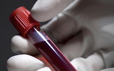 What Your Blood Type Can Tell You Concerning Your Health Risks