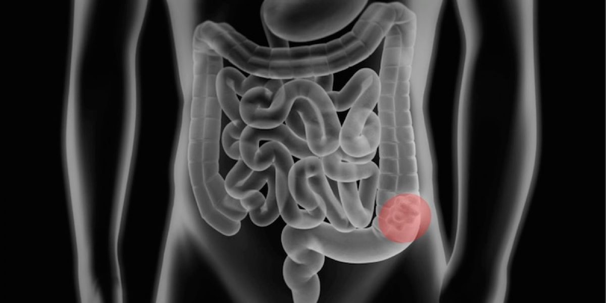 Gastrointestinal Disorders: Causes, Symptoms And How To Achieve A Healthier System