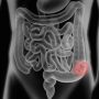 Gastrointestinal Disorders: Causes, Symptoms And How To Achieve A Healthier System