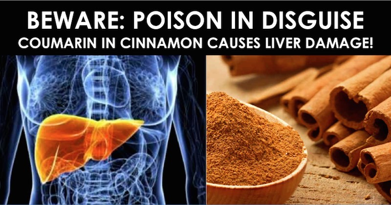 fake cinnamon causes liver damage