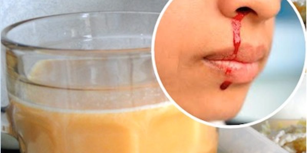 This Unique Juice Combo STOPS Nose And Gum Bleeds, Bruises And Internal Bleeding