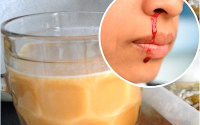 This Unique Juice Combo STOPS Nose And Gum Bleeds, Bruises And Internal Bleeding