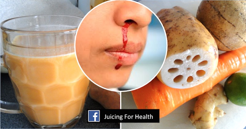 Stop Nose Bleed With This Unique Juice Combo That Repairs