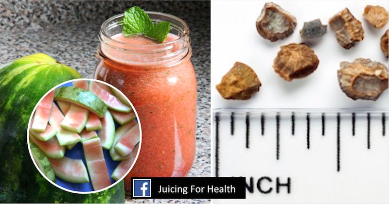 watermelon rind juice kidney stones