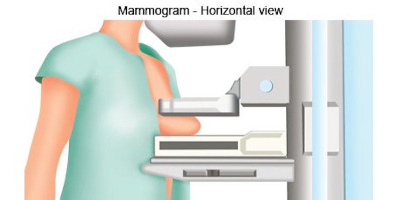 mammograms don't save lives
