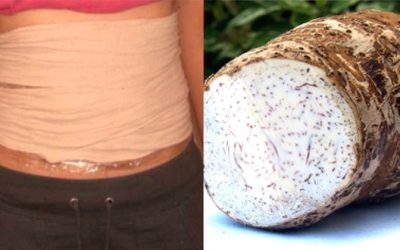 Taro Plaster: Shrink And Dissolve Cysts And Fibromas With This Traditional Remedy