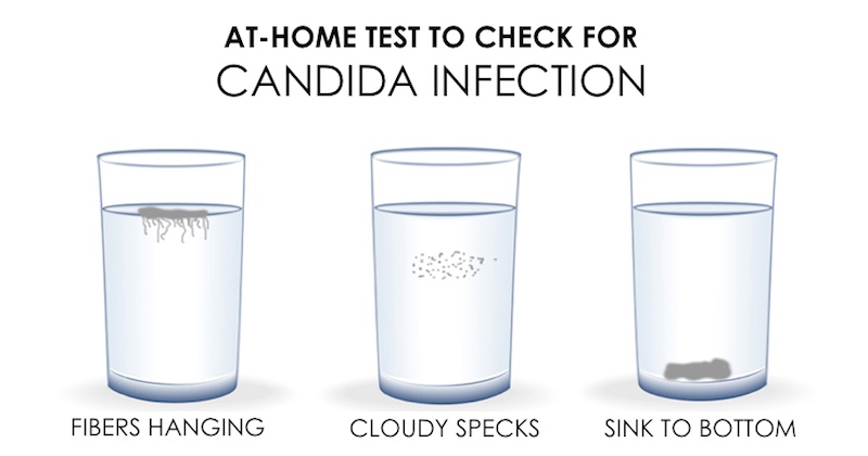 candida overgrowth test