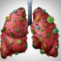 Detoxify Your Lungs: 8 Must-Do Strategies To Heal From Respiratory Problems