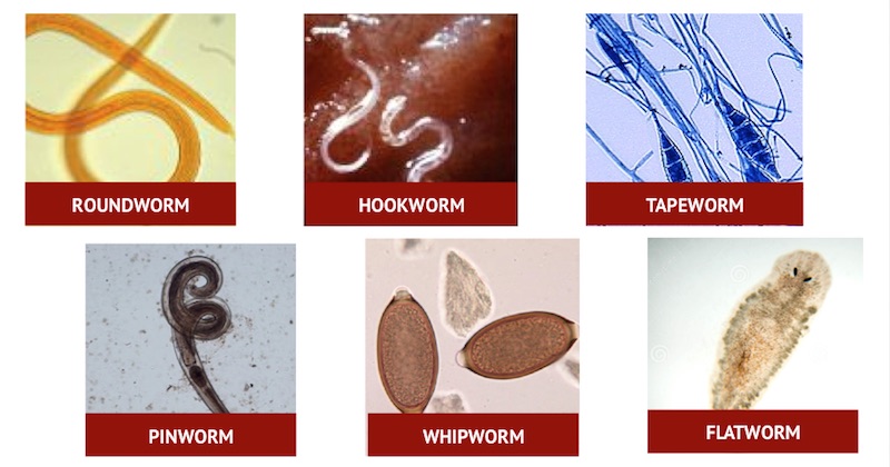 Worms In Humans Human Body - greenwaysome