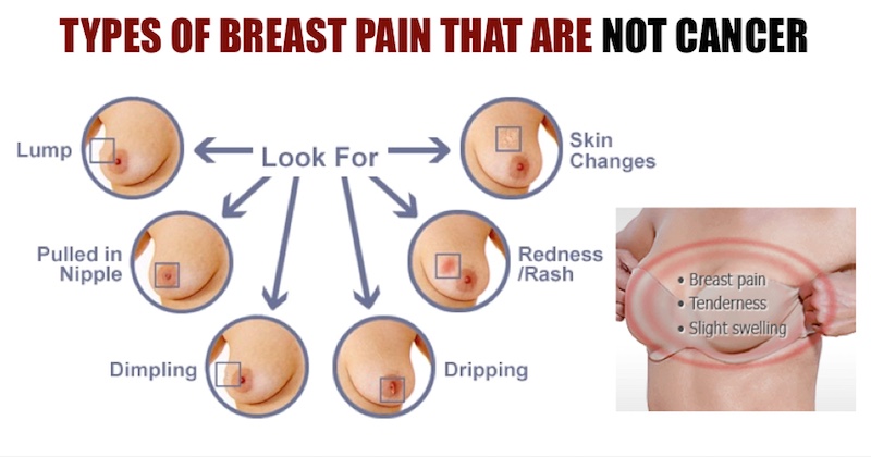 Worried about breast pain?