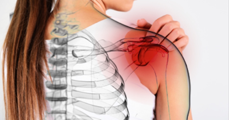 Natural Treatment For Frozen Shoulder And Be Healed Within Days