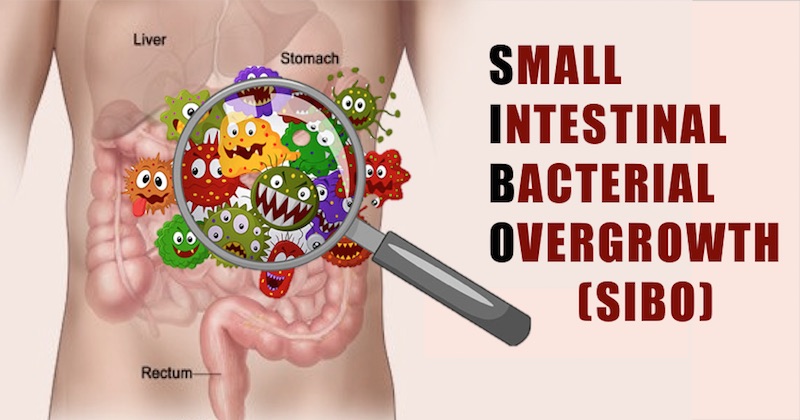 bacterial overgrowth in stomach