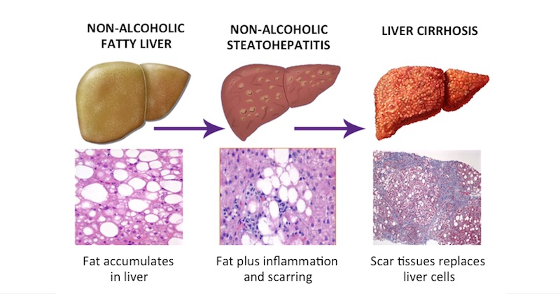 What Foods Elevate Liver Enzymes In Dogs