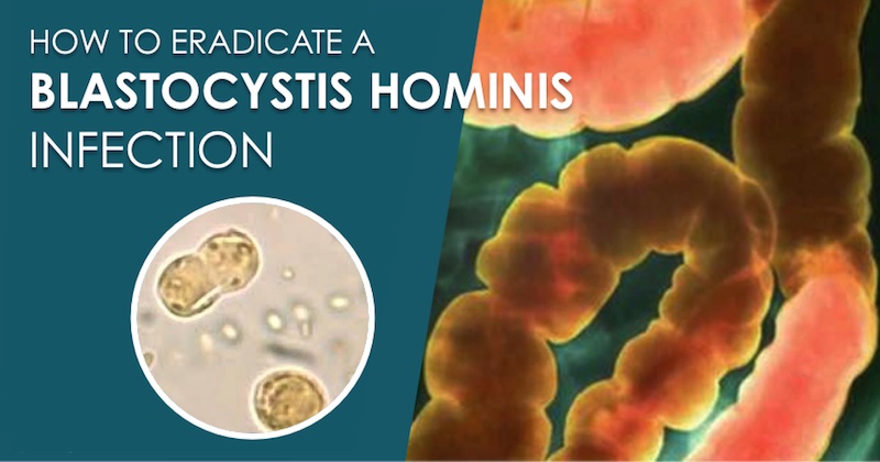 blastocystis hominis infection