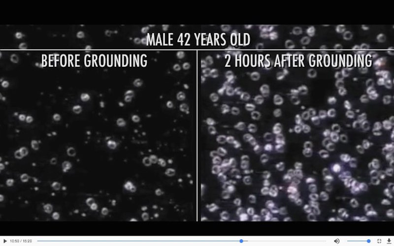 live blood cell analysis before and after grounding