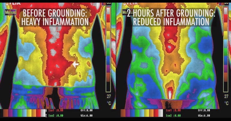 Inflammation level before and after grounding